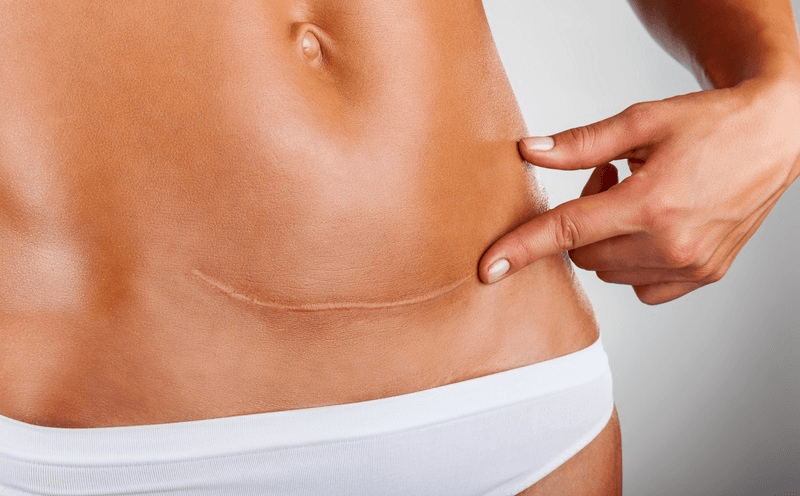 Post-surgical recovery and wound healing support