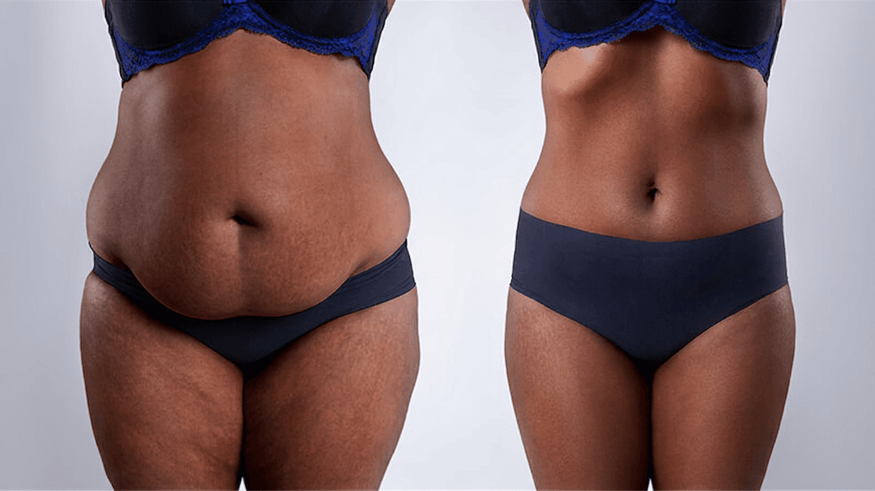 Medical Weight Loss Protocols